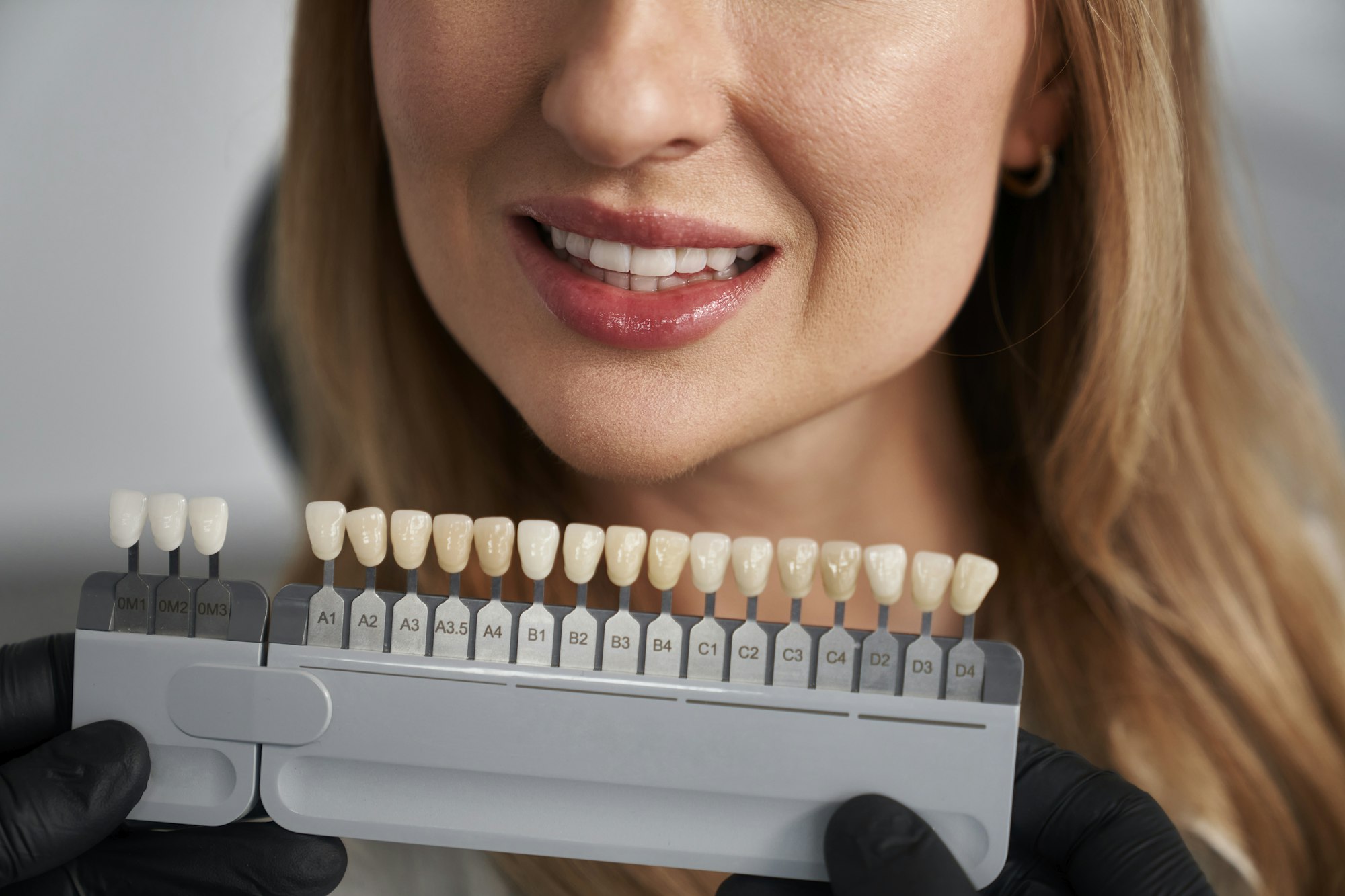 Woman having cosmetic dentistry at dentist’s office